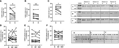 Acute endurance exercise modulates growth differentiation factor 11 in cerebrospinal fluid of healthy young adults